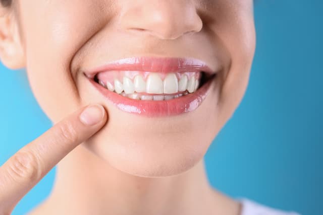 A woman pointing to her healthy teeth and gums