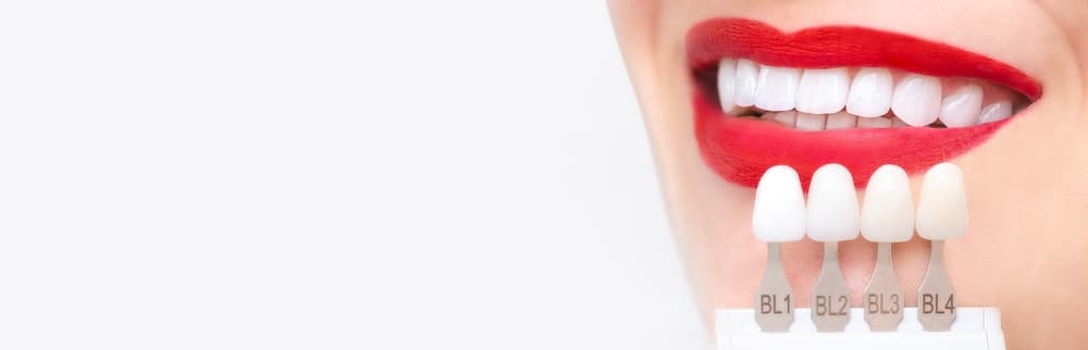 Matching veneer shades against a patient’s smile