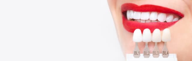 Matching veneer shades against a patient’s smile